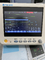 Hospital Emergency Multiparameter Monitor Mini Ambulance Patient Monitor