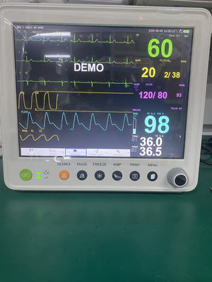 Portable Patient Monitor With Parameters Of ETCO2 ECG NIBP SPO2 RESP TEMP PR