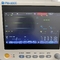 Highly Connected Multi Parameter Patient Monitor With Alarm System