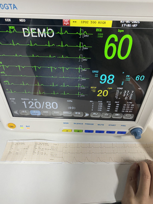 Multi-working Modes Health Monitoring Vital Signs Patient Monitor for Clinic